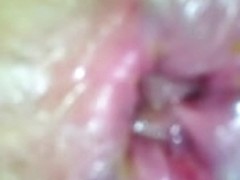 diminutive anal gape by finger in petite chocolate hole
